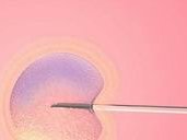 中山三院做试管婴儿多少钱？